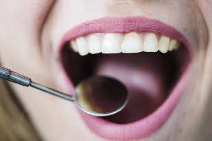 open-mouth-of-woman-with-dentist-mirror_23-2147862096